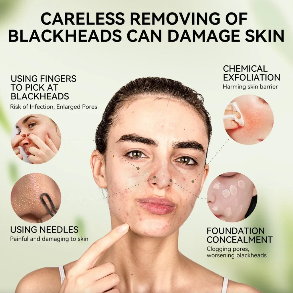 3.0 Máscara Facial Removedora De Cravos 30g Charcoal