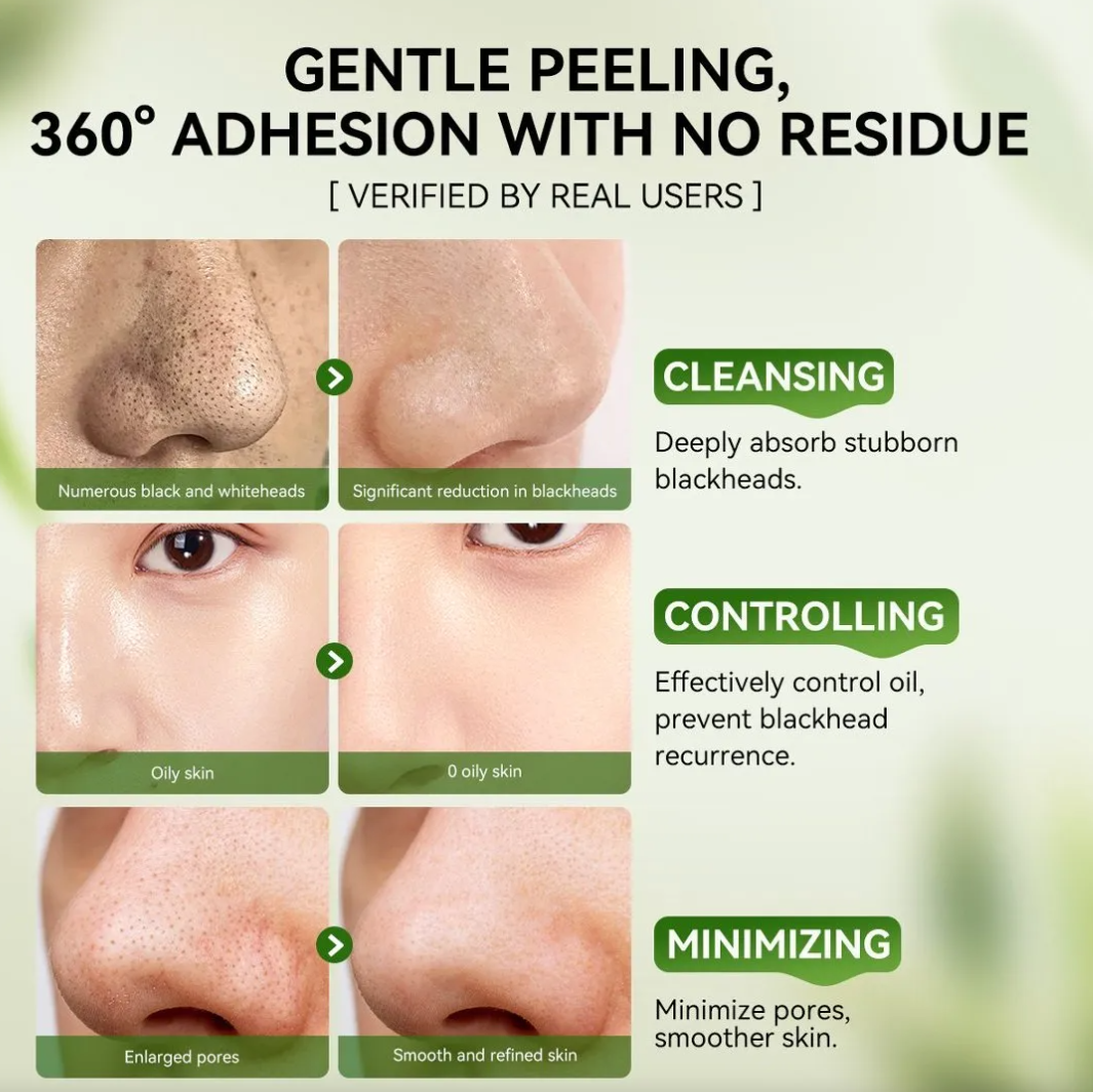 3.0 Máscara Facial Removedora De Cravos 30g Charcoal